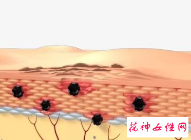 皮肤细胞更新是什么意思